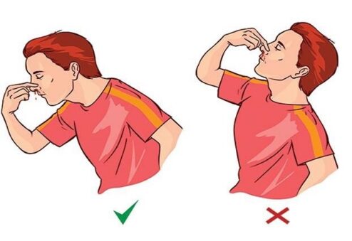 Cần xử lý đúng cách khi bị chảy máu mũi